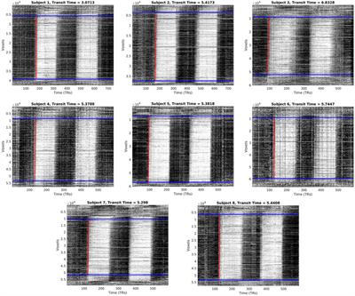 Using carpet plots to analyze blood transit times in the brain during hypercapnic challenge magnetic resonance imaging